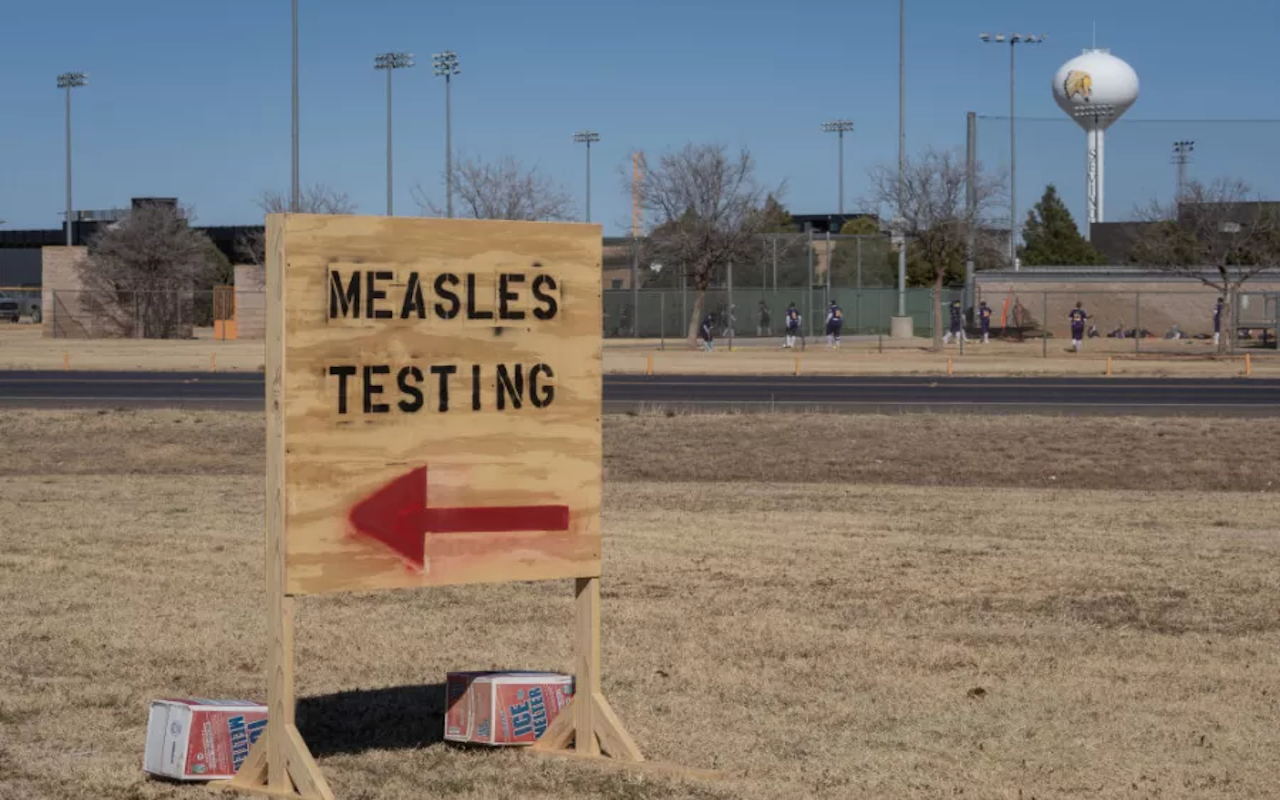 US Measles Surge: Highest Cases in 33 Years